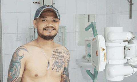 Nhạc sĩ Trần Lập đã bước qua ca phẫu thuật đầu tiên