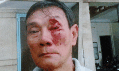 Tự xưng thiếu tá công an đánh người nhằm độc chiếm tài sản?