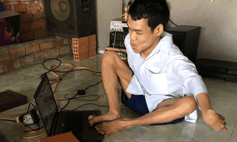 Bi kịch của thi sĩ "ngờ nghệch" làm thơ bằng chân!