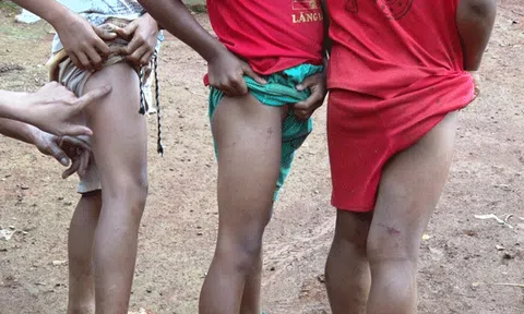 Dân điêu đứng vì suối Đắk Dao ô nhiễm 