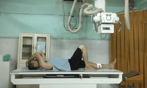  Mr. Đàm khâu 6 mũi ở chân vì bị tai nạn khi tập liveshow