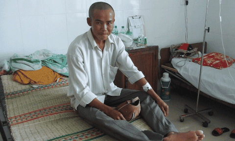 Ăn xong gỏi thịt heo, 16 người tức tốc nhập viện 