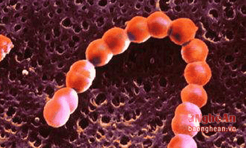 Nóng: Xã ở Nghệ An có 20 học sinh bị suy thận, 2 em đã tử vong