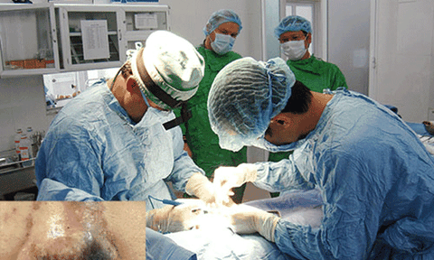 Tai biến do làm đẹp không dao kéo 