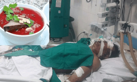 Ăn tiết canh lợn, người đàn ông hoại tử hết chân tay