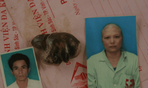 Nhói lòng gia đình có 4 người đều mắc bệnh nặng