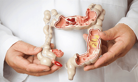 Quan sát những tín hiệu cảnh báo ung thư