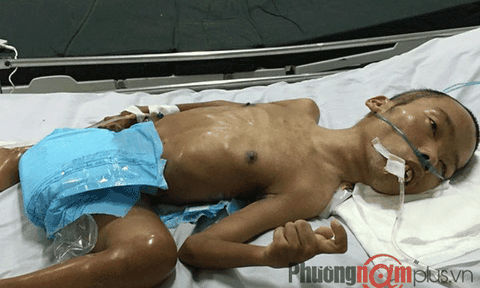 Người đàn ông 38 tuổi, nặng 5kg ở Nghệ An cần sự giúp đỡ của cộng đồng