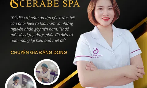 Cerabe Spa cơ sở 29 thực hiện điều trị nám chuẩn y khoa bởi chuyên gia Đặng Dong