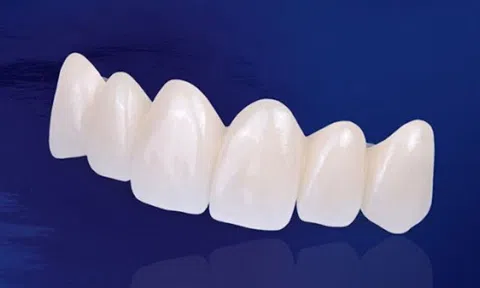 Nha khoa Quốc tế DAISY địa chỉ bọc răng sứ Cercon uy tín, chất lượng