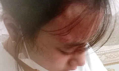 Hà Tĩnh: Khởi tố người đàn ông hành hung dã man nữ sinh lớp 10