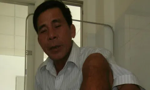 Cách sơ cứu khi bị rắn lục cắn có nguy cơ tử vong cao