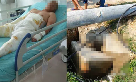 Nghệ An: Người đàn ông bị điện giật có gia cảnh khó khăn cần sự chung tay của cộng đồng